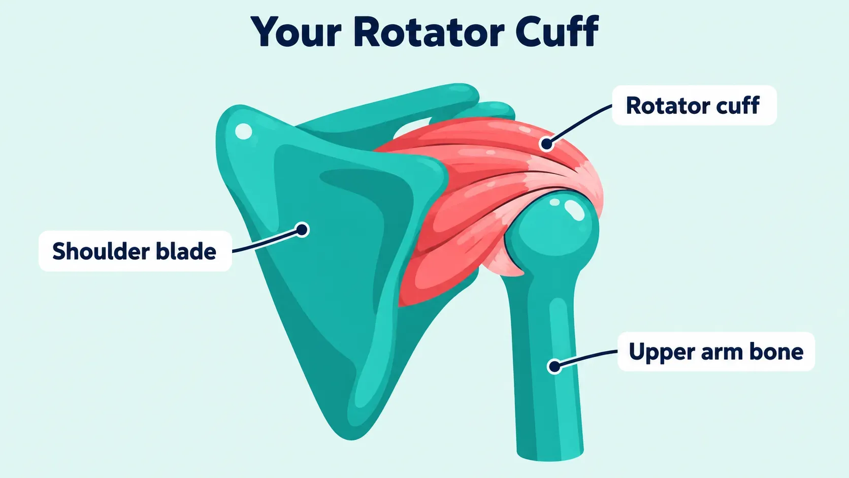 Diagram of the back of the right shoulder showing the rotator cuff, a band of muscle and tendon that runs from the shoulder blade over the ball at the top of the upper arm bone